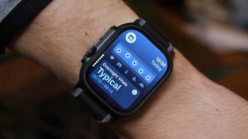 How the Apple Watch Vitals app works—and four tips to get more out of it